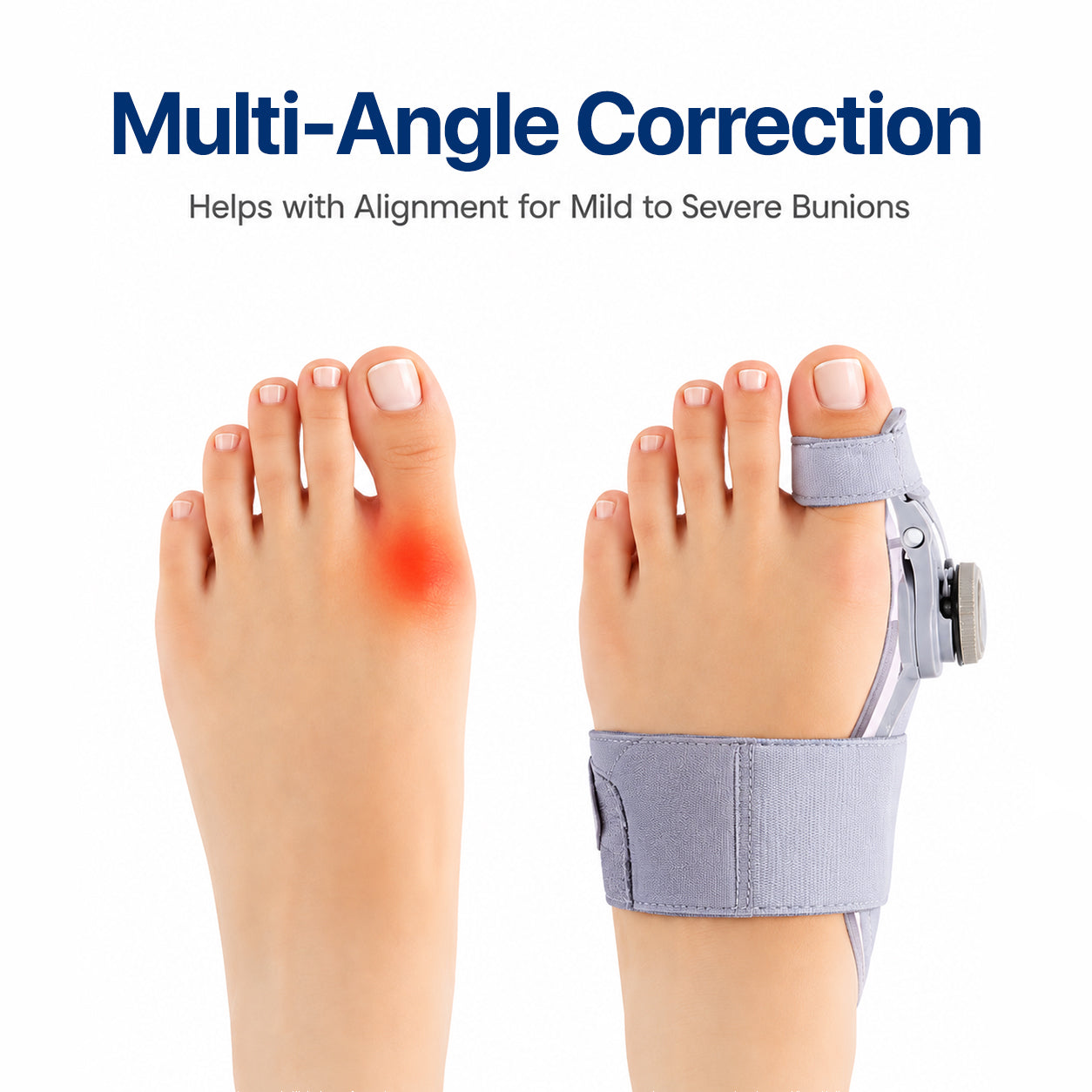 Toe Alignment Corrector – Realign Your Toe